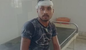 हमले में घायल चालक 