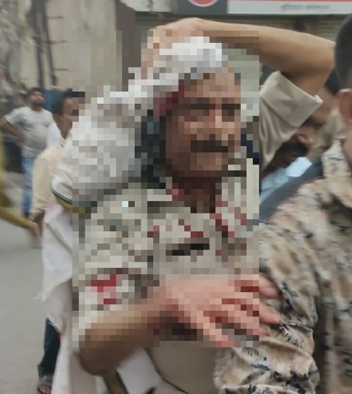 injured 22Scope News