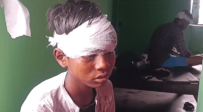 Big Breaking-मामूली विवाद में हिंसक झड़प, कई के फूटे सिर