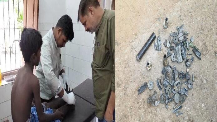 मोर्टार का वेस्टेज गोला फटने से एक बच्चा घायल, RTC बिग्रेड का चल रहा था अभ्यास