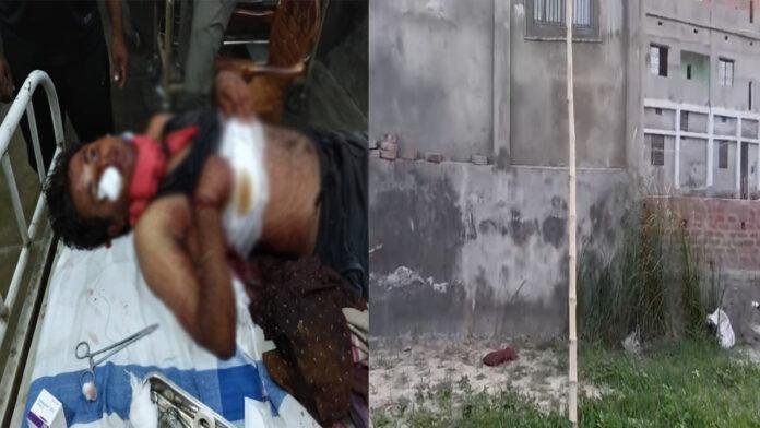 घर में डकैती का प्रयास, अपराधियों ने परिवार वालों पर किया चाकू से हमला