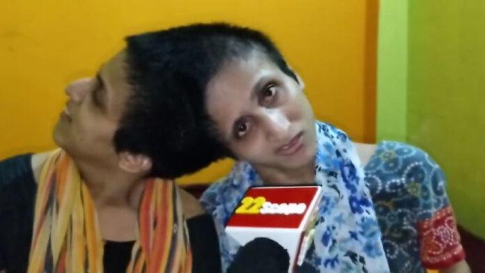 बेहद तकलीफ के दौर से गुजर रही है 2 जुड़वा बहनें
