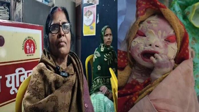 प्रसव के लिए आई महिला ने एक अजीबोगरीब बच्चे को दिया जन्म
