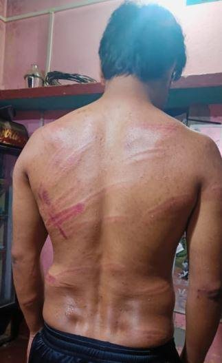 Giridih Clash पर बाबूलाल का हमला, एक-एक ज़ख्म का हिसाब लिया जाएगा और... Giridih Clash पुलिस की मारपीट में घायल युवक
