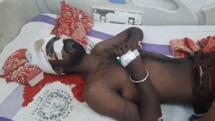 बकाया पैसा मांगने पर व्यक्ति को मारपीट कर गंभीर रूप से किया घायल