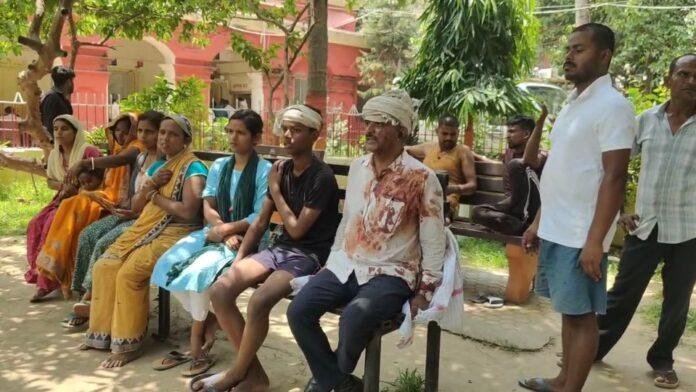 Bhagalpur