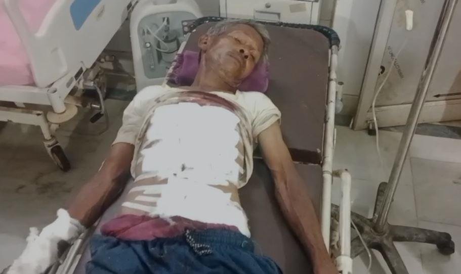 Gumla : गए थे बकरी खोजने मिल गई बम! कुलमुंडा जंगल में फटा बम, ग्रामीण गंभीर... Gumla : घायल की स्थिति गंभीर