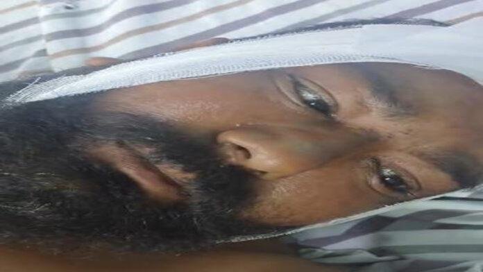 अहियापुर गोलीकांड में घायल मंटू सिंह का काटा गया पैर 