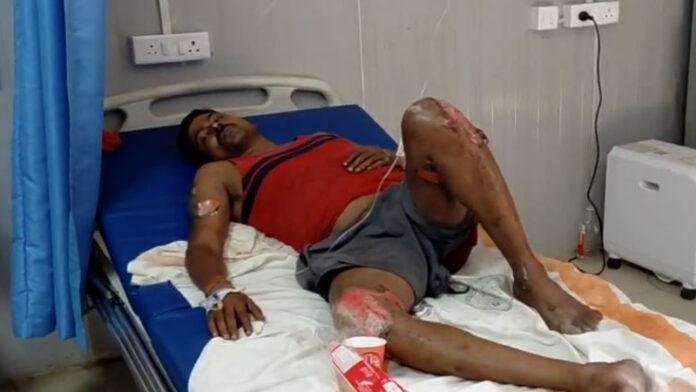 तेल टैंकर व टेलर में टक्कर, लगी आग, झुलस गए ड्राइवर