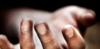 नाक के दाग को लेकर थी परेशान, 17 वर्षीय छात्रा ने की आत्महत्या