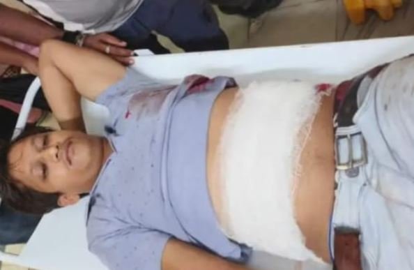 गढ़वा में दिनदहाड़े गोलीकांड से सनसनी, इंदिरा गांधी रोड पर युवक को मारी गोली – हालत नाजुक, पुलिस आरोपी की तलाश में जुटी