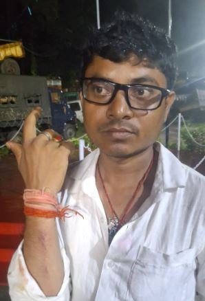 डुमरी विधायक Jairam Mahato पर मारपीट का आरोप, नवाडीह थाना में केस दर्ज... Jairam Mahato के द्वारा मारपीट का चोट दिखाता शख्स