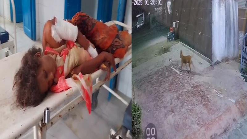कुचायकोट में आवारा कुत्तों का आतंक, महिला को काटकर किया जख्मी