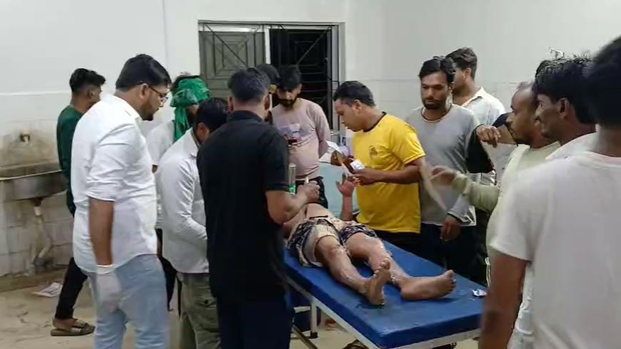 मोहर्रम जुलूस के दौरान आग से दिखा रहे थे तरतब, 15 लोग झुलसे, 6 रिम्स रेफर