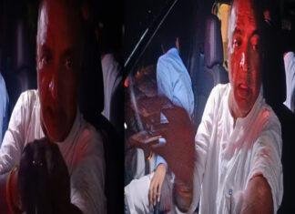 टेकारी विधानसभा में NDA प्रत्याशी पर काफिले पर हमला, लगी गंभीर चोट टेकारी विधानसभा में NDA प्रत्याशी पर काफिले पर हमला, लगी गंभीर चोट