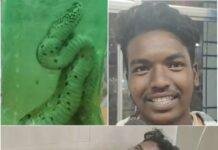 रसेल वाइपर ने युवक को डसा, तो दोस्त ने सांप को बोतल में बंदकर पहुंचा अस्पताल, डॉक्टर भी रह गए दंग