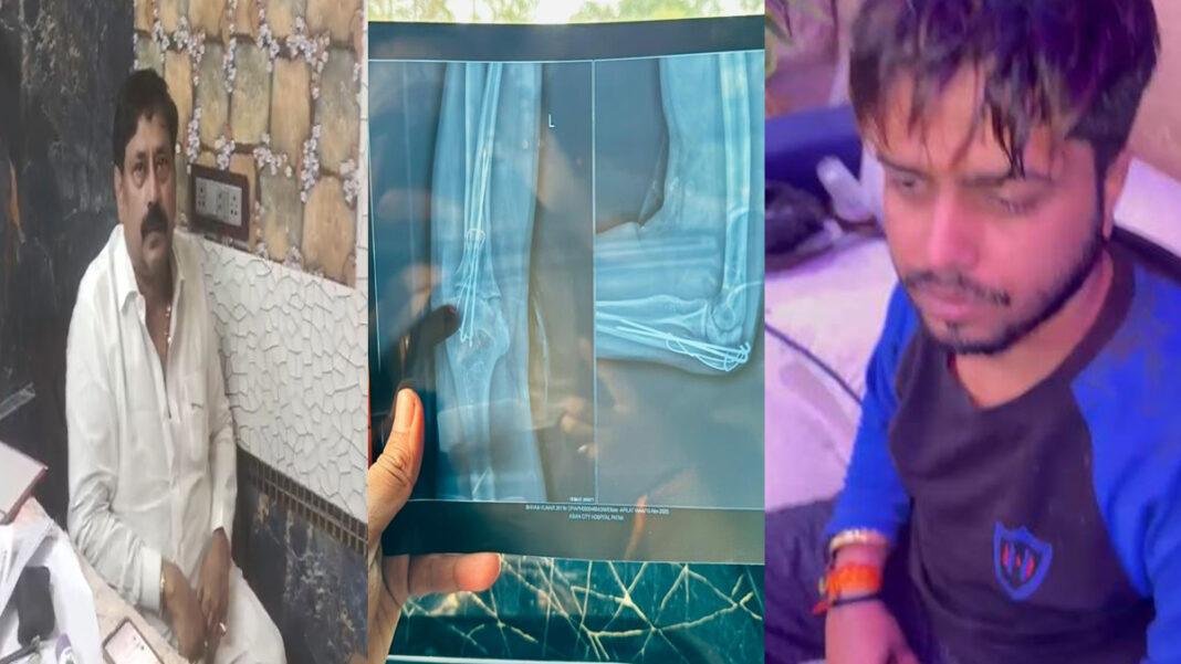 सियासी रंजिश में RJD नेता के पुत्र पर जानलेवा हमला, सिर पर आई चोट