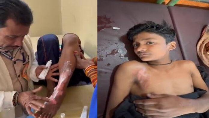 जश्न के बीच मातम, गणतंत्र दिवस की झांकी में लगी आग, 5 बच्चे झुलसे स्कूल प्रबंधन की बड़ी लापरवाही आई सामने