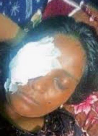 1828 Ranchi Crime: बच्चों के विवाद में महिला पर हमला, हिंदपीढ़ी में आंख फूटी, FIR दर्ज