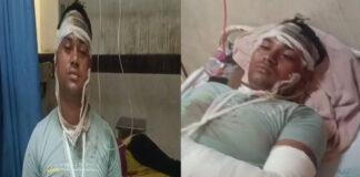आपसी विवाद में बड़े भाई ने छोटे भाई व उसके दंपती पर किया जानलेवा हमला, दोनों गंभीर रूप से घायल आपसी विवाद में बड़े भाई ने छोटे भाई व उसके दंपती पर किया जानलेवा हमला, दोनों गंभीर रूप से घायल