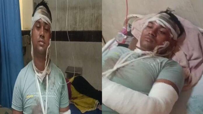 आपसी विवाद में बड़े भाई ने छोटे भाई व उसके दंपती पर किया जानलेवा हमला, दोनों गंभीर रूप से घायल