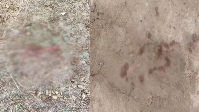 Motihari Hatya धारदार हथियार से हमला, 2 लोग गंभीर रूप से घायल