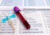 Blood Test Cancer Detection